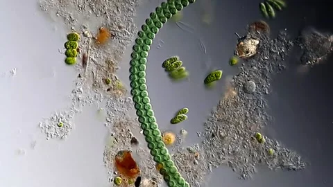Cyanobacterium algae under microscopy view 库存影片 306574690