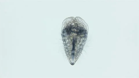Cydippid larva Ctenophora under a microscope, juvenile larva, found in Indian Stock Footage 168243632