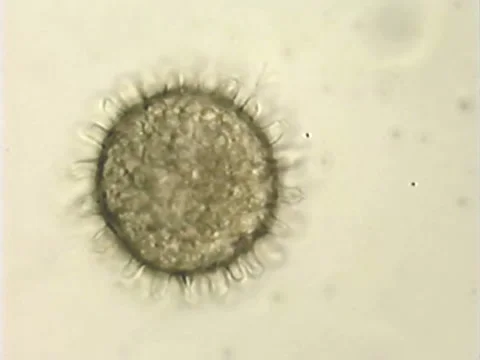 Cyst micro14 Video stock 932792