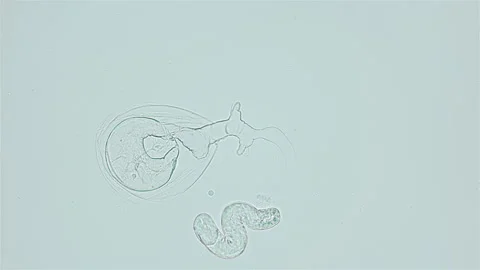Cyst or capsule of parasitic worm cercaria Lecithaster salmonis under a Stock Footage 247314977