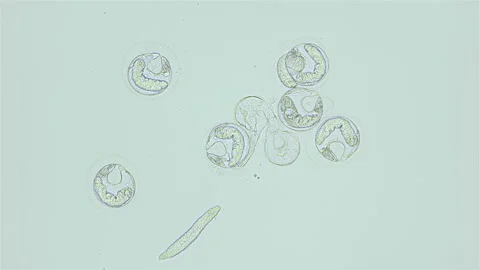 Cyst or capsule of parasitic worm cercaria Lecithaster salmonis under a Stock Footage 247356853