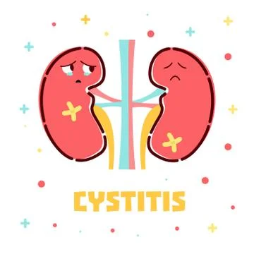 Cystitis kidneys poster Stock Illustration