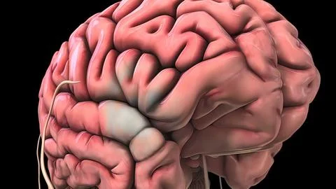 Damage to the brain causes brain hemorrhage Stock Illustration