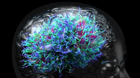 Damage brain, causing symptoms like delirium and confusion or dementia. Stock Illustration