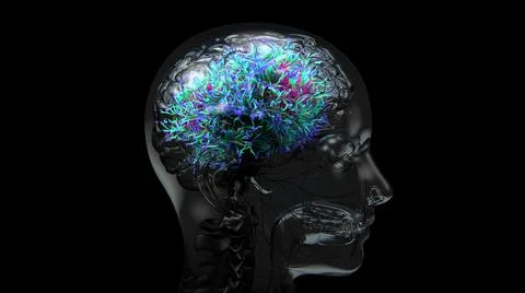 Damage brain, causing symptoms like delirium and confusion or dementia. Illustrazione stock