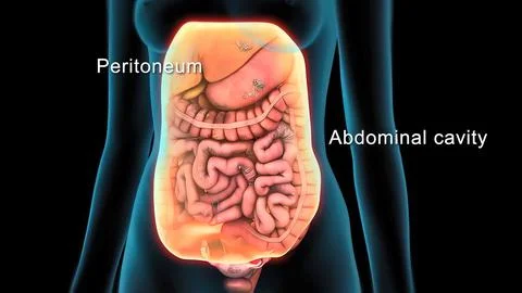 Damaged failed small intestine in human body. Stock Illustration