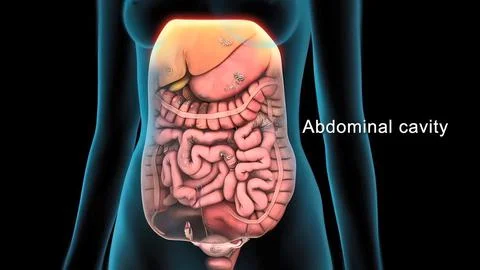 Damaged failed small intestine in human body. Illustrazione stock