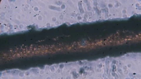 Damaged Hair Cuticle and Split Ends Microscopic View Stock Footage 320242586