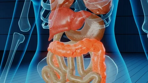 Damaged-intestine Stock Footage 237591293