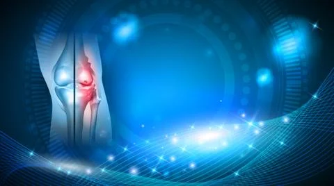 Damaged joint abstract blue background Illustrazione stock