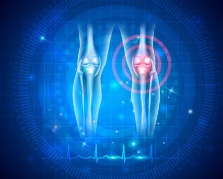 Damaged joint and normal cardiogram Ilustração Stock