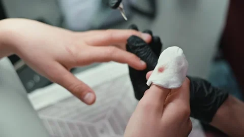 Damaged nail during manicure, cotton pad with blood on finger Stock Footage 339093904