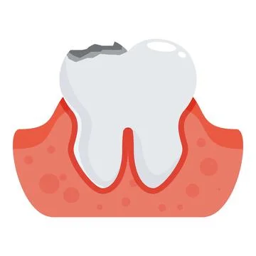 Damaged tooth showing gingivitis and needs dental care Illustrazione stock