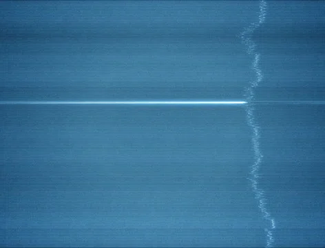 Damaged TV Static Background Loop with Thick Scanlines Stock Footage 47682848