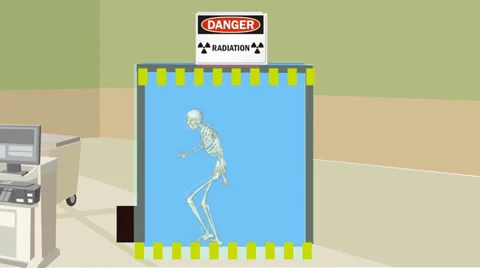 Dance of the X-ray Video stock 38050723