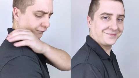 Dandruff before and after. The man on the left shows his shoulder, which has a l Stock Footage 149733136