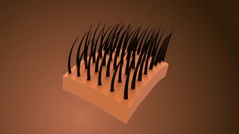 Dandruff free Stock Footage 102547296