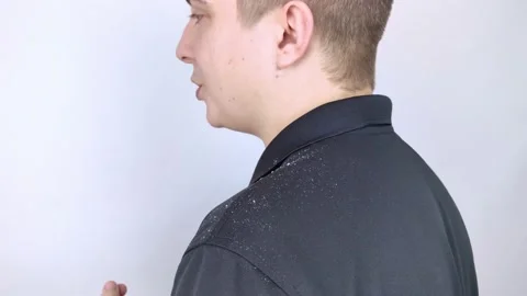 Dandruff on a man's shoulder. Side view of a man who has more dandruff flakes on Stock Footage 149733054