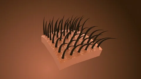 With dandruff(Loop) Stock Footage 102547316