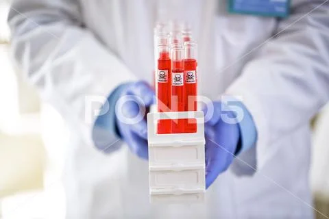 Danger toxic chemicals in tubes Stock Photos
