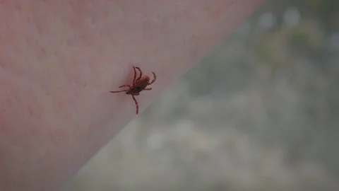 Dangerous parasite Ixodes tick on human skin. Video stock 231722531