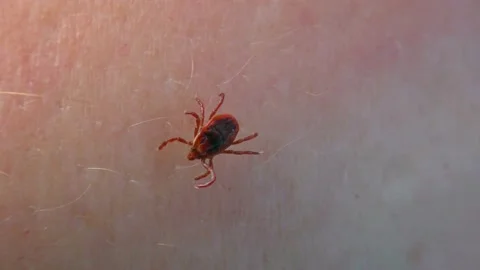 Dangerous vector Scale tick on human skin. Stock Footage 170967957