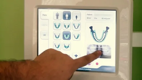 Dantist seting Panoramic Radiology Machine Stock-Footage 75307860