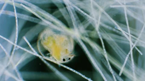 Daphnia and algae Stock Footage 313174051