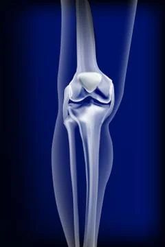 Dark blue transparent view of bones the of knee Stock Illustration