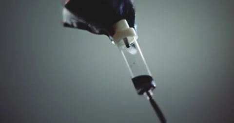 Dark liquid dripping from an IV bag into a drip chamber Stock Footage 255752724