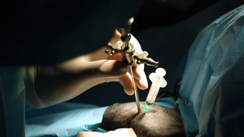 Dark operating room, surgeon operates joint in black dog, removes bone growths Stock Footage 128281344