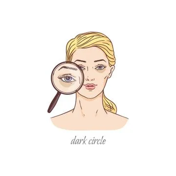 Dark under eye circle bag problem - blonde woman with magnifying glass Stock Illustration