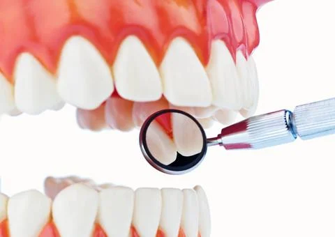 Das Modell eines Gebisses wird untersucht, Zahnarzt, Dentist, Zahnlabor, M... 스톡 사진
