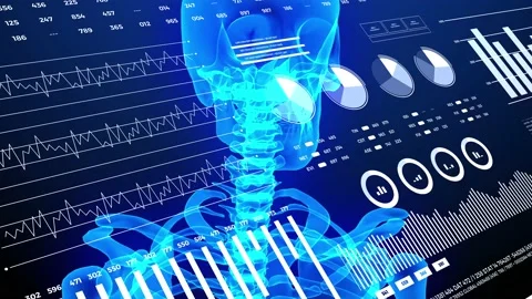 Data and report statistics, animation with graph diagrams. Stock Footage 168707185