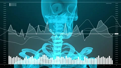 Data and report statistics, animation with graph diagrams. Stock Footage 168708279