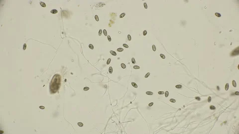 Dead colony of the ciliates of the coleps, which are largely in dirty water Stock Footage 97433372
