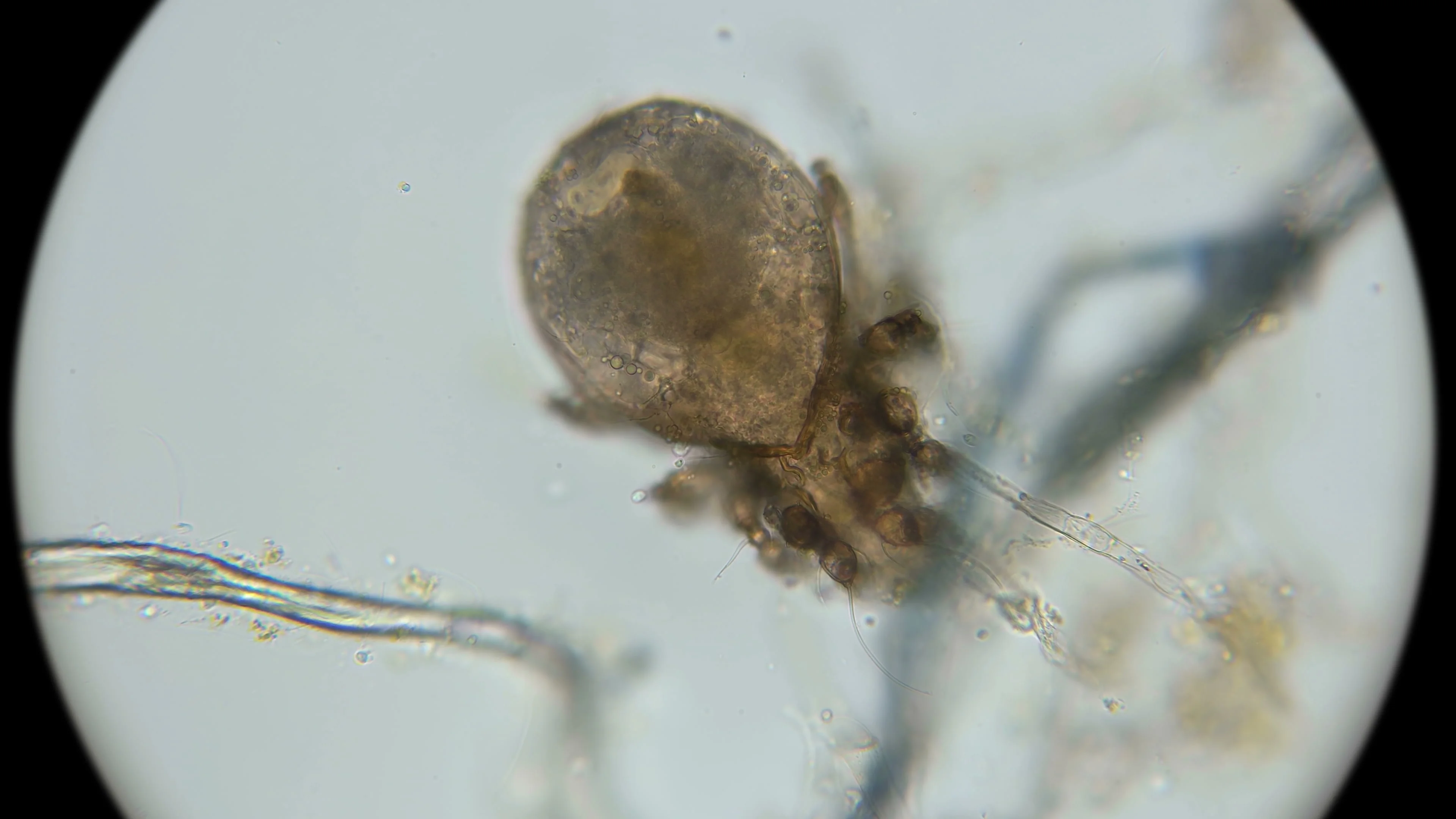 dust mite microscope