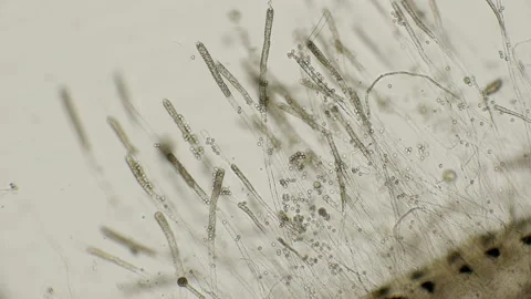 In the Dead fish started , the water molds Saprolegnia and other parasites that Stock Footage 92337851