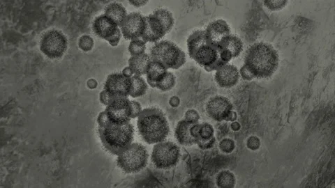 Deadly virus seen thorugh microscope lens, micro Stock Footage 141576383