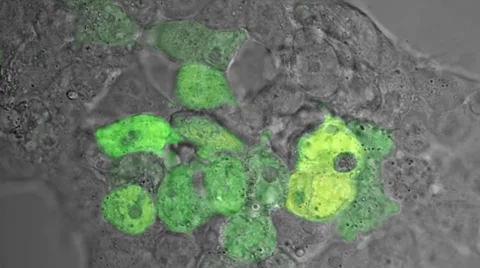 Death of cells Stock Footage 29226734