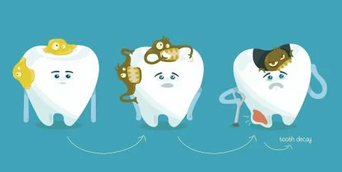 Decay tooth step by step Stock Illustration