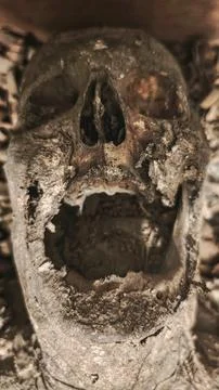 Decayed Human Skull with Open Jaw Stock Photos