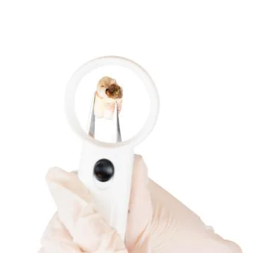 Decayed Tooth Stock Photos