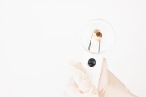 Decayed Tooth Stock Photos