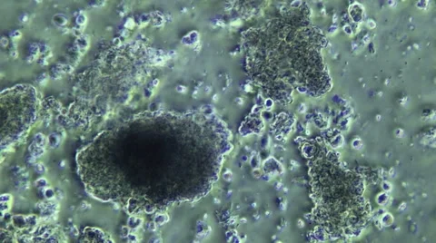 Decomposing Organic Flesh With Bacteria Microscope view 800x Stock Footage 45892188