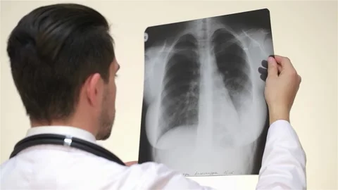Dedicated doctor analyzing an x-ray image of lungs Stock Footage 311234065
