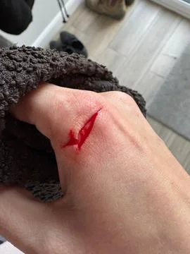 Deep, bleeding cut being washed with water Stock Photos