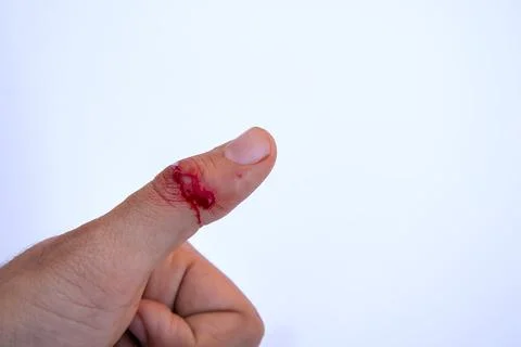 Deep Knife Cut Thumb, Close-Up Injury Fresh Blood, White Background, Copyspace Stock Photos