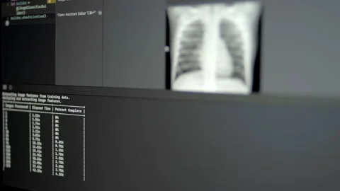 Deep Learning Neural Network Classificat... | Stock Video | Pond5