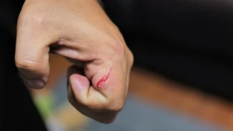 Deep scratches, cut on man hand skin. Stock Footage 232120976